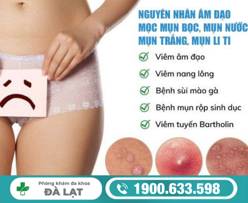 Hình ảnh minh họa